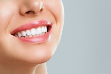What Are All-On-4 Dental Implants?
