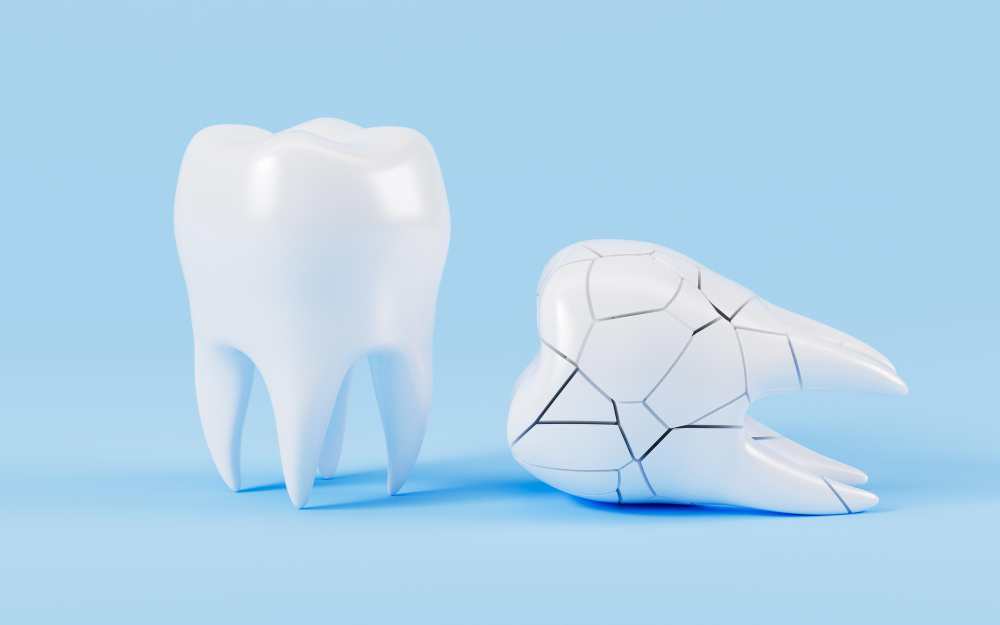 Questions About Broken Tooth Treatment